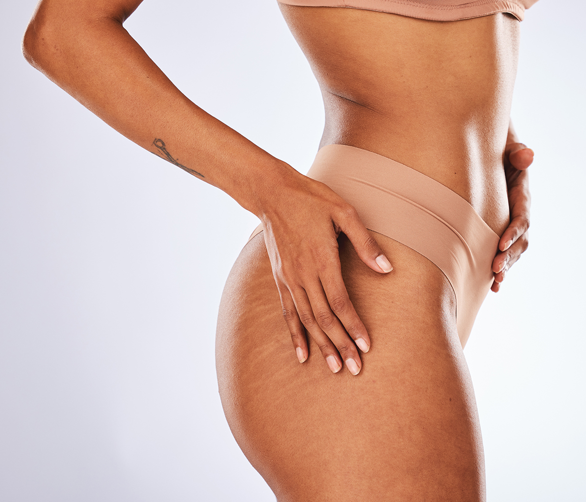 Patients can control stretch marks with Fraxel laser therapy