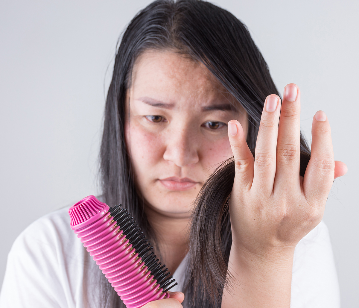 Treating hair loss without surgery