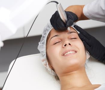 fractional laser resurfacing from dermatologist annapolis