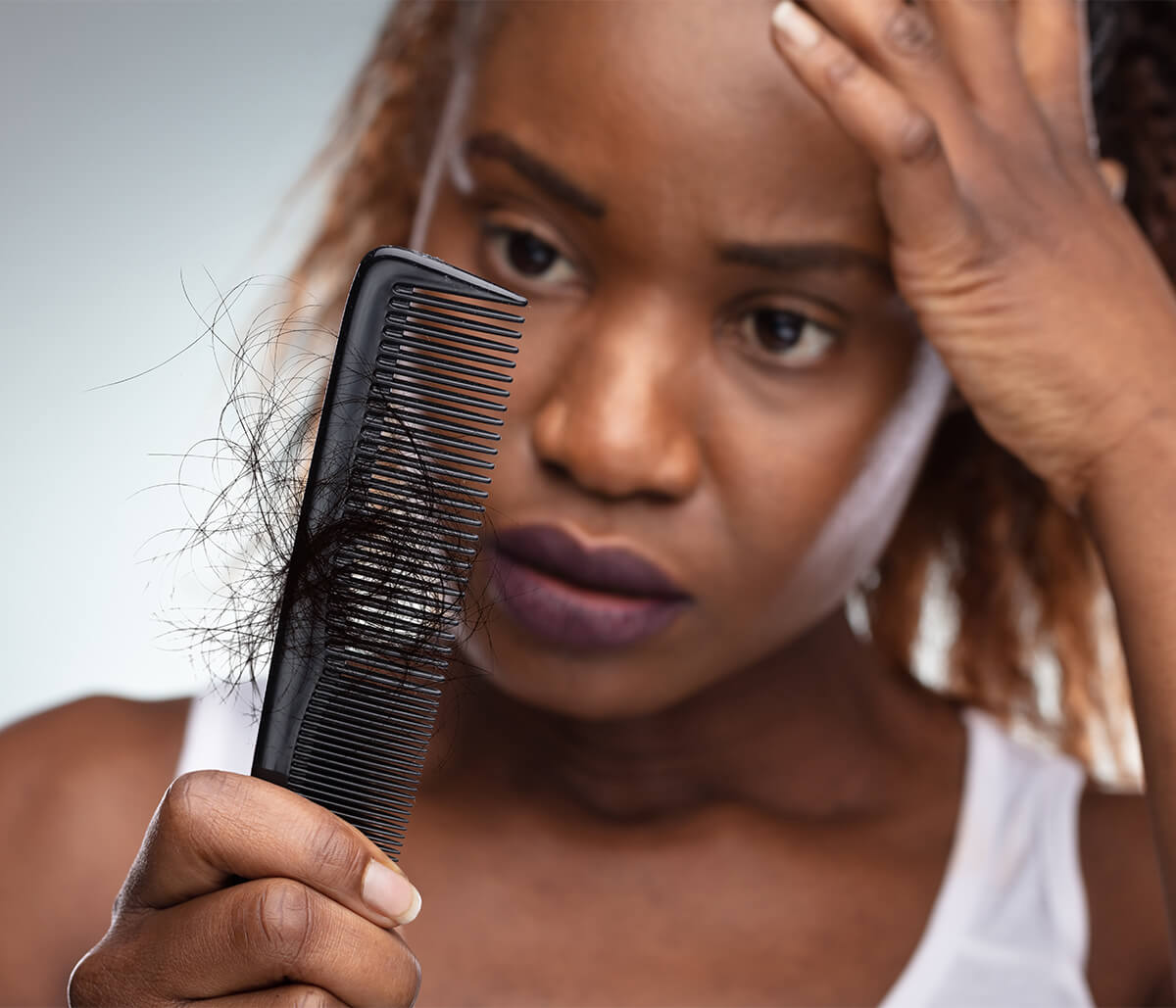 Hair Loss Treatment Options in Washington DC Area