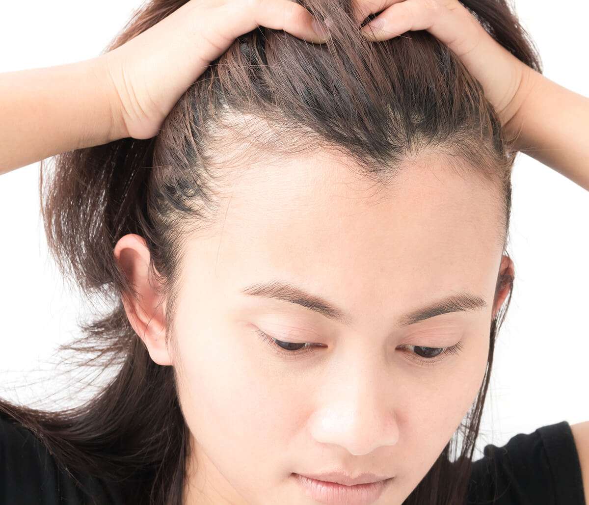 How Do Dermatologists Treat Alopecia in Washington, DA Area?