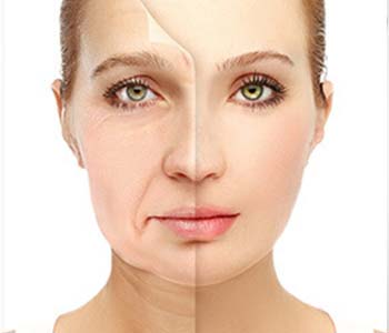 Sculptra treatment to control aging process