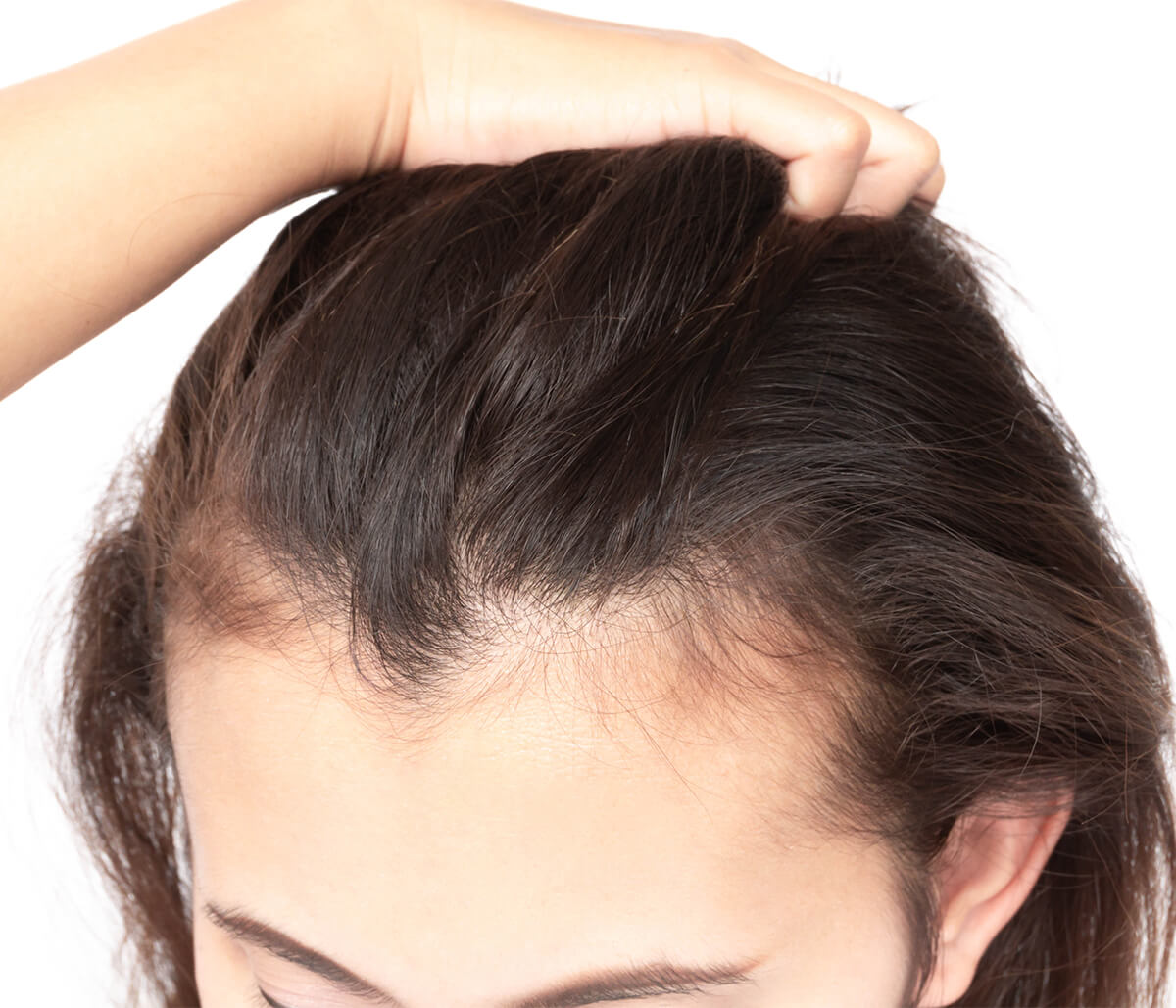 Dermatologist for Hair Loss in Washington Area